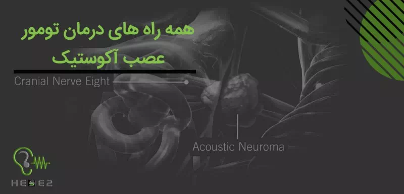 انواع راه های درمان تومور عصب شنوایی