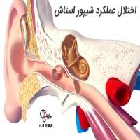 اختلال شیپور استاش گوش، علائم، تشخیص و درمان