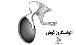 بیماری اتواسکلروز چه علائم و راههای درمانی دارد؟