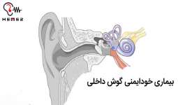 بیماری خود ایمنی گوش داخلی از تشخیص تا درمان