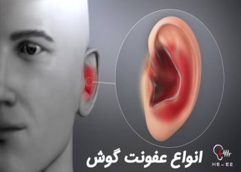 انواع عفونت گوش و علائم آن